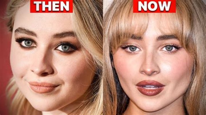 Did Sabrina Carpenter's Nose Job Change Her Look?