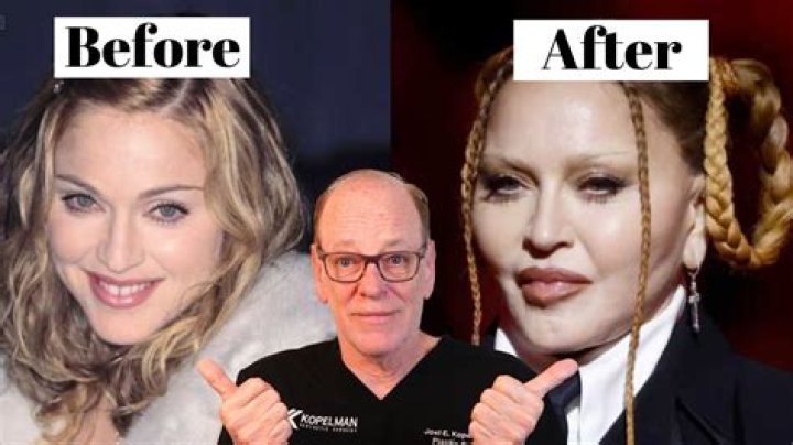 Gloria Borger's Plastic Surgery Transformation: The Truth Revealed