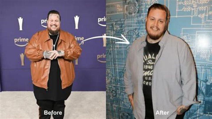 Justin Bieber's Transformation: Weight Loss Journey In 2024