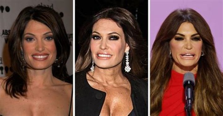 Kimberly Guilfoyle's Facial Transformation: Uncovering Its Evolution