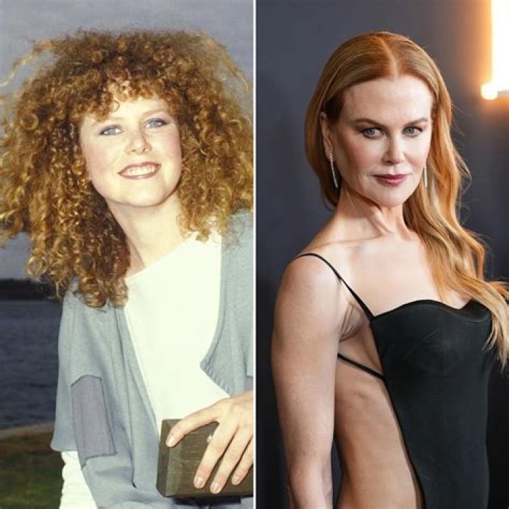 Nicole Kidman's Stunning Transformation: The Truth Behind Her Surgery