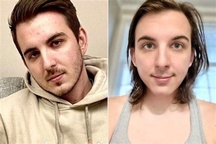 Noah Galvin's Transformation Before Transition: An Inspiring Story