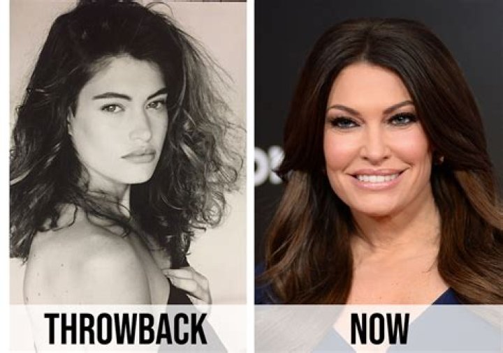 Sabrina's Plastic Surgery Transformation: Before And After Photos.