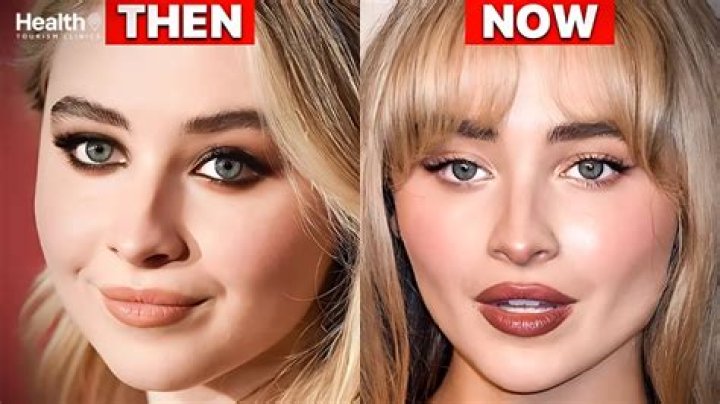 Sabrina Carpenter's Plastic Surgery: Transformation And Procedures
