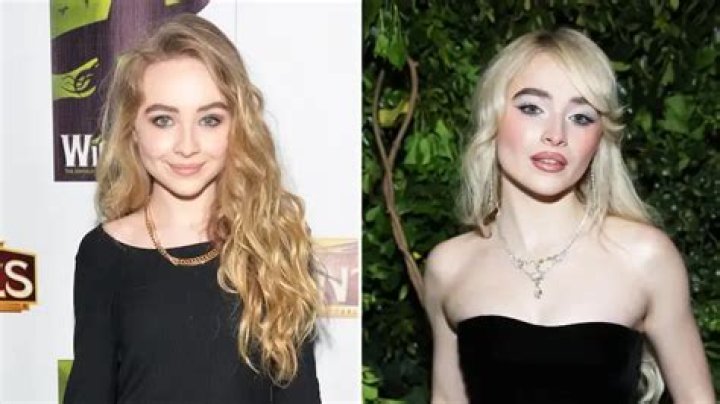 Sabrina Carpenter's Surgery: Has She Gone Under The Knife?