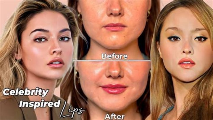 Sabrina Carpenter's Transformation: Uncovering Her Natural Beauty Before Lip Fillers