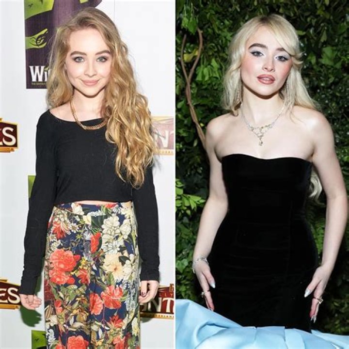 Sabrina Carpenter Nose Surgery: Transformation And Controversy