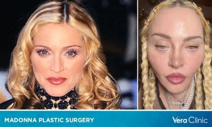 Savrina Carpenter's Rumored Plastic Surgery: Fact Or Fiction?