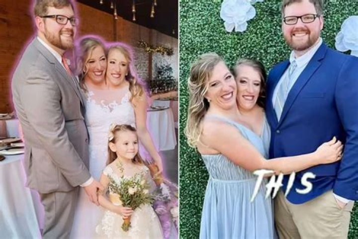 The Heartbreaking Family Tragedy Of Abby And Brittany Hensel: A Life Lived In Two Bodies