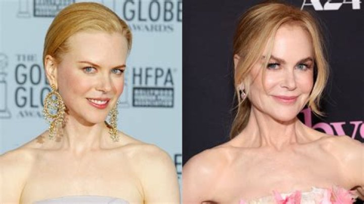 The Intriguing Truth: Nicole Kidman's Plastic Surgery Journey