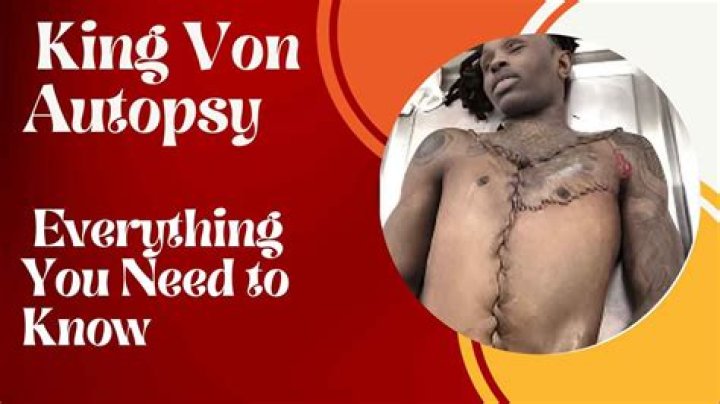 The Tragic Demise Of King Von: An Autopsy Report