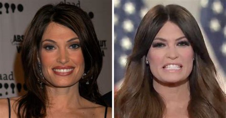 The Ultimate Guide To Kimberly Guilfoyle's Facial Transformations