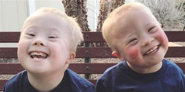 The Unbreakable Bond: George Clooney's Inspiring Twins With Down Syndrome