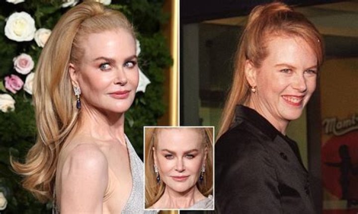 The Unrecognizable Transformation: Nicole Kidman's Appearance Before And After Surgery