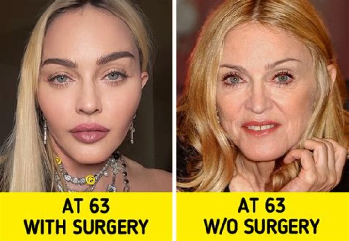 Unbelievable Zach Braff: The Truth About His Rumored Plastic Surgery