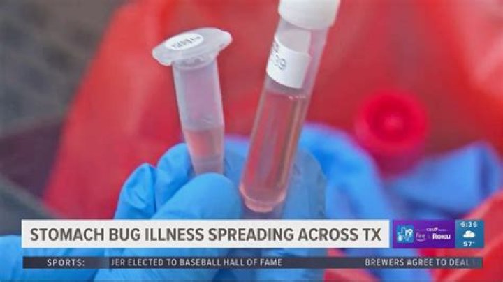 Understanding The Current Stomach Virus Outbreak Map