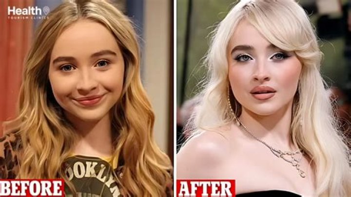 Unlocking The Truth: Did Sabrina Carpenter Undergo Plastic Surgery?