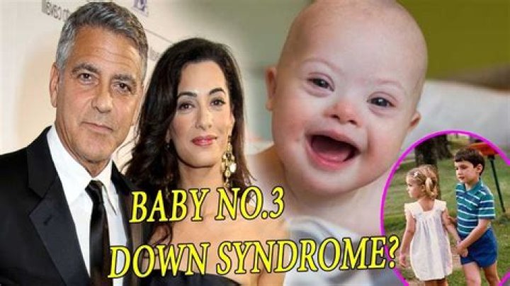 Unraveling The Truth: Does George Clooney's Son Have Down Syndrome?