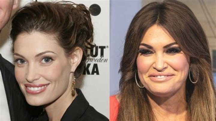 Unveiling Kimberly Guilfoyle's Journey: Before And After Surgery