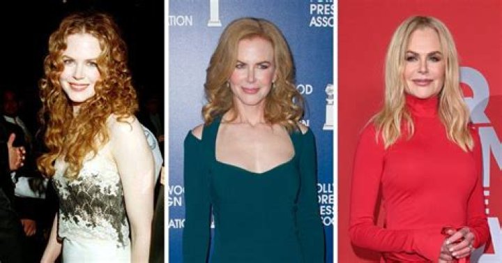 Unveiling Nicole Kidman's Transformation: A Look Back At Her Appearance Before Surgery
