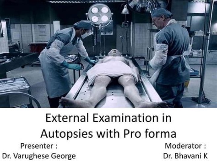 Unveiling Tarrare's Extraordinary Organs: A Post-Mortem Examination