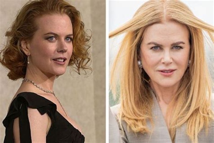 When Did Nicole Kidman Get Plastic Surgery? Uncovering The Truth